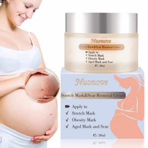 Stretch Mark Cream for Pregnancy